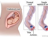 MỘT SỐ DẠNG BẤT THƯỜNG CỦA DÂY RỐN