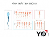 TINH DỊCH ĐỒ